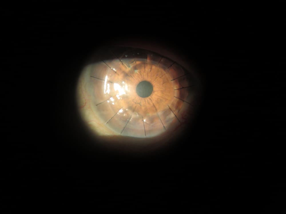 NYU Langone Eye Center - Bay Ridge