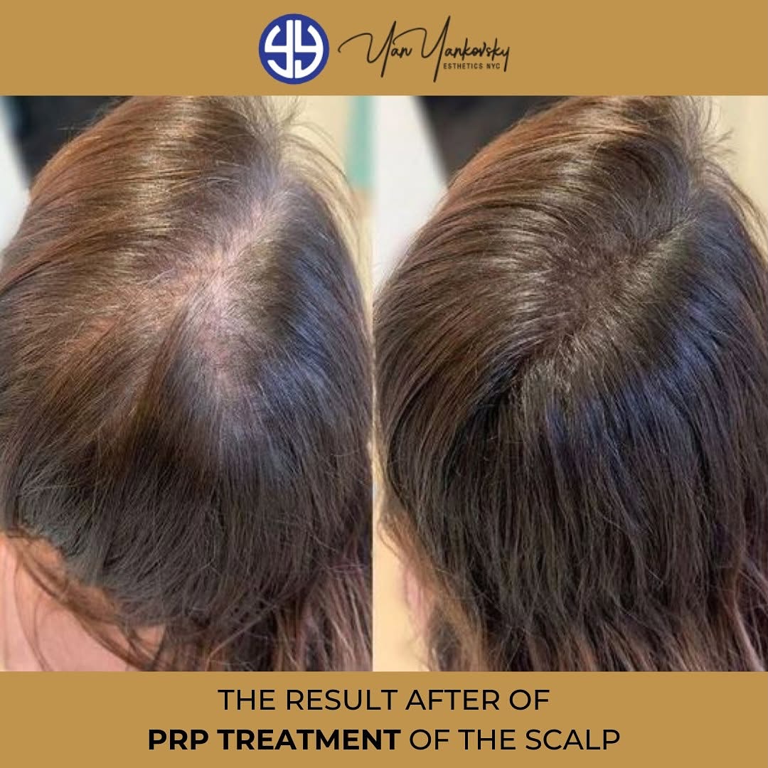 EstheticsNYC 1221 Quentin Rd 3rd floor, Brooklyn New York 11229