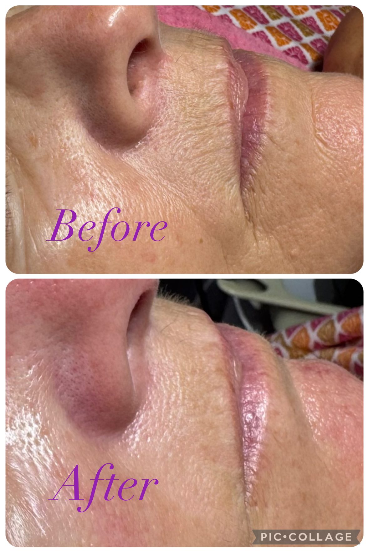 Clifton Park Laser And Wellness