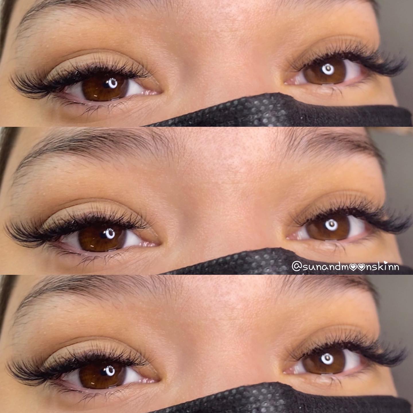 Sun and Moon Esthetics
