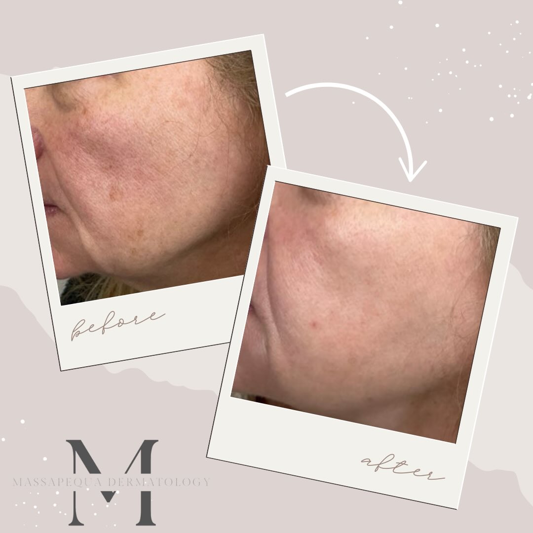 Massapequa Dermatology, PLLC