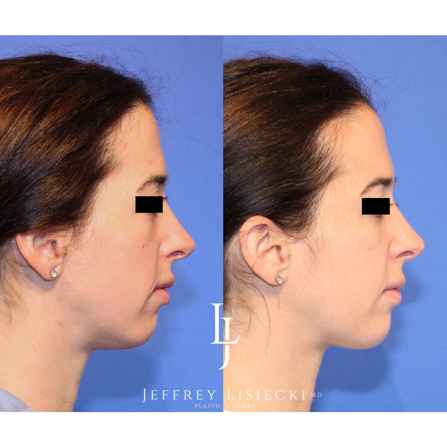 Jeffrey Lisiecki, MD