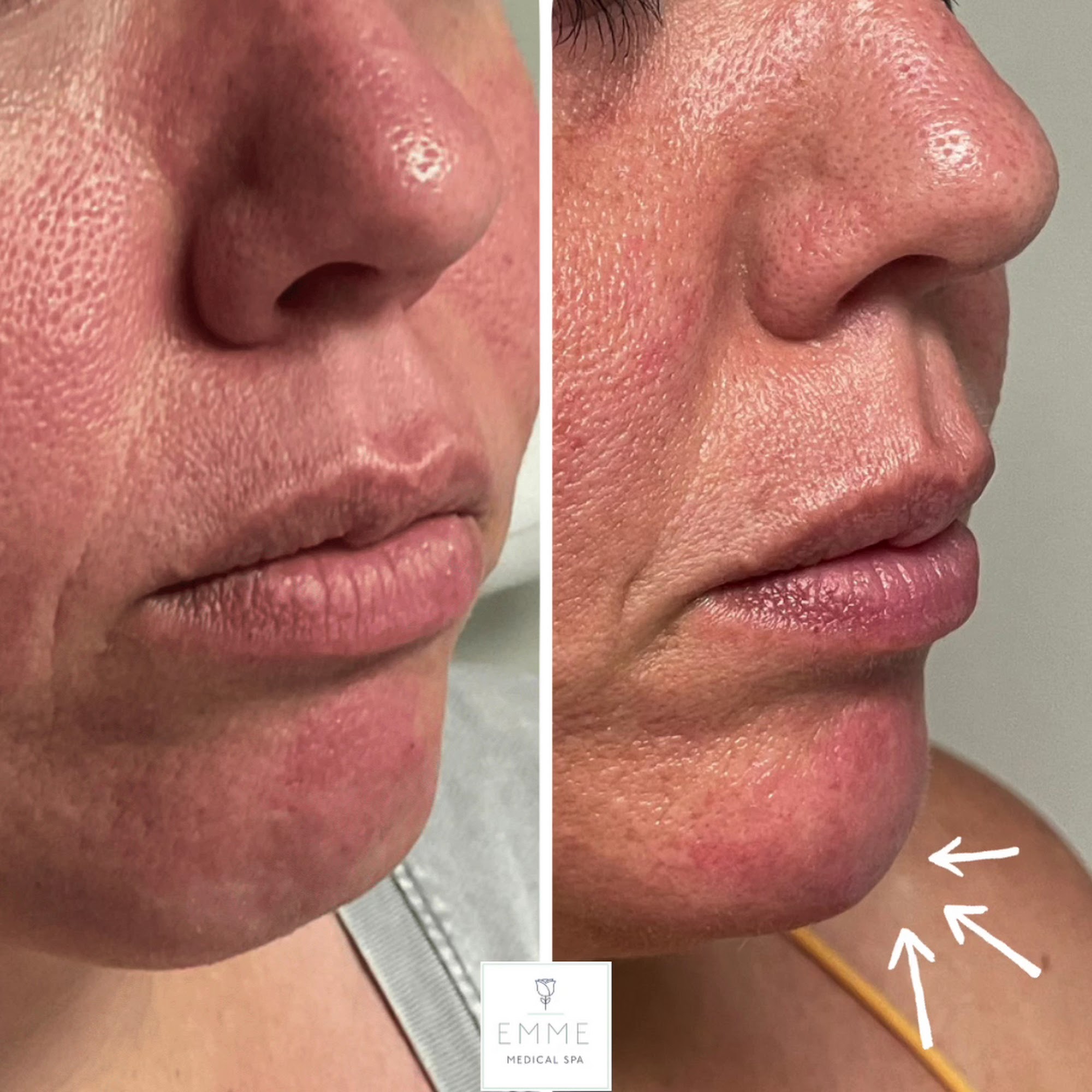 EMME Skin Studio