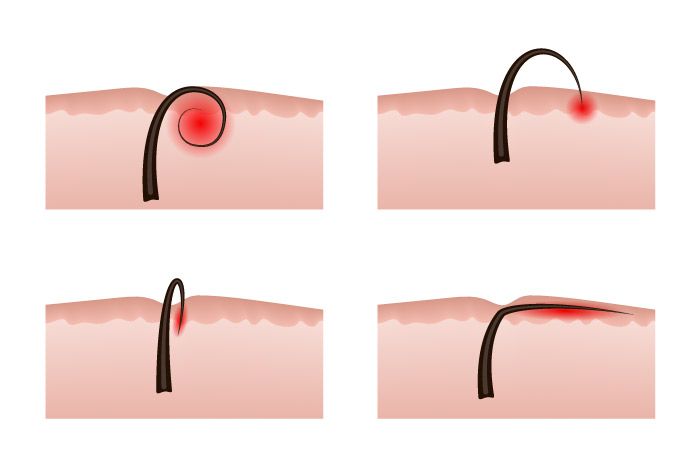 Sinful Skin by Kolene 421 Seneca St, Utica New York 13502