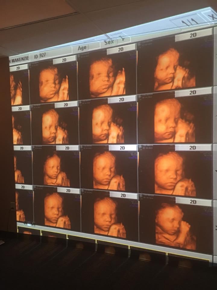 4d Ultrasound Photography LLC