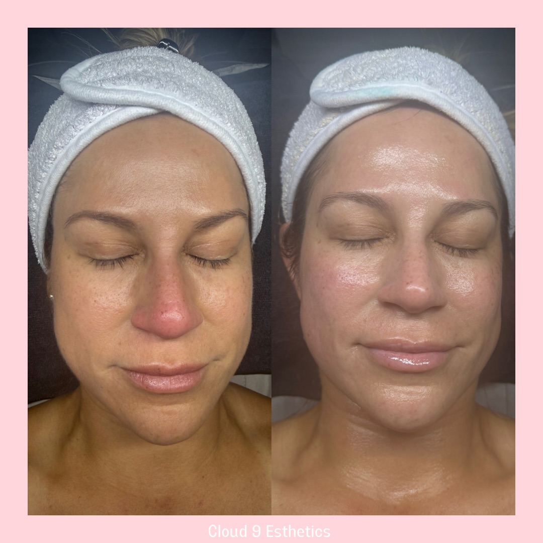 Cloud 9 Esthetics