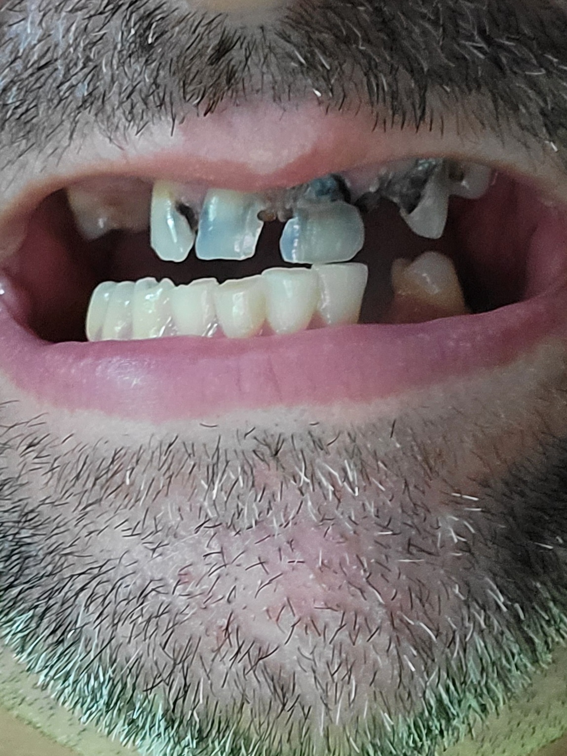 Springboro Dental Group