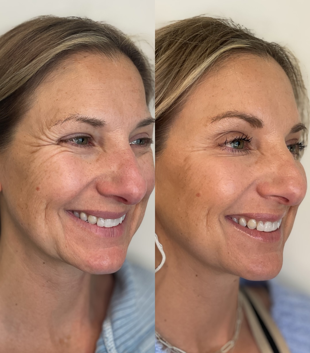 HaleStorm Aesthetics and Wellness