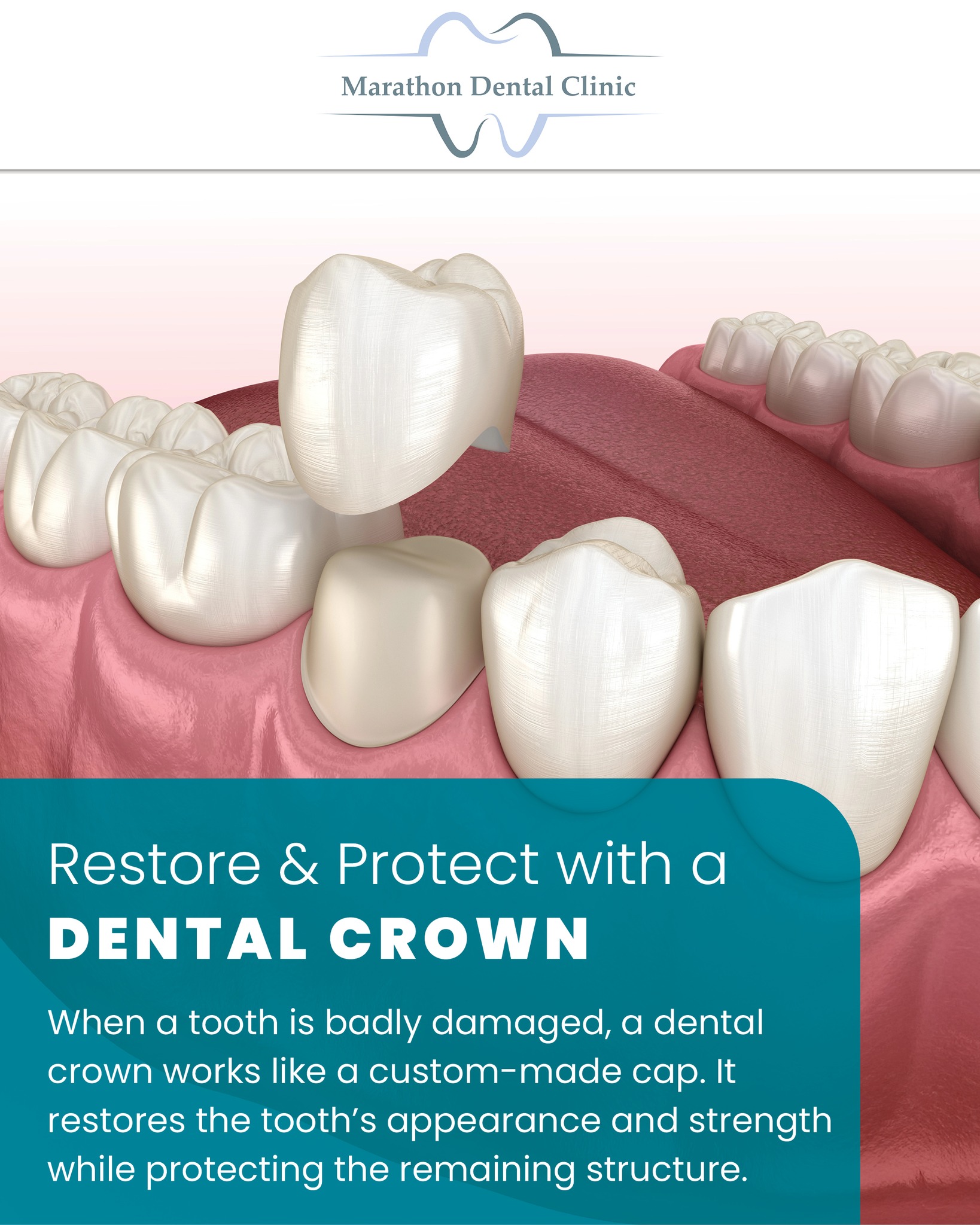 Marathon Dental Clinic