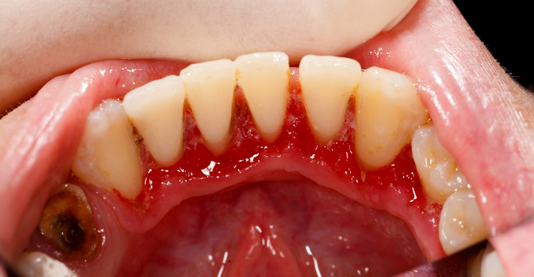 Weston Dental Office - Dr. Fariba Shokoohi Razi & Associates 1928 Weston Rd, Toronto, ON 
