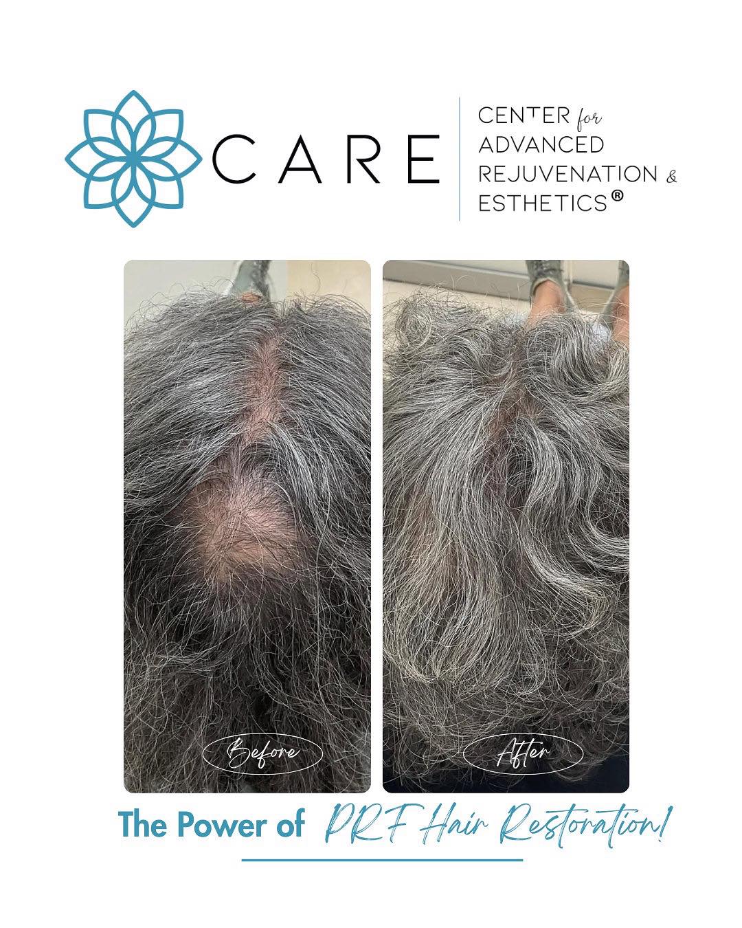 CARE Esthetics 501 Portway Ave, Hood River Oregon 97031