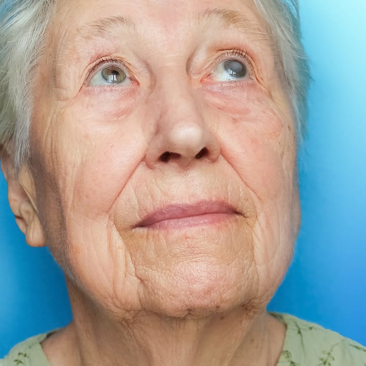 Scheiman, Mitchell, Od - Dr Phillips Eye Care Ctr