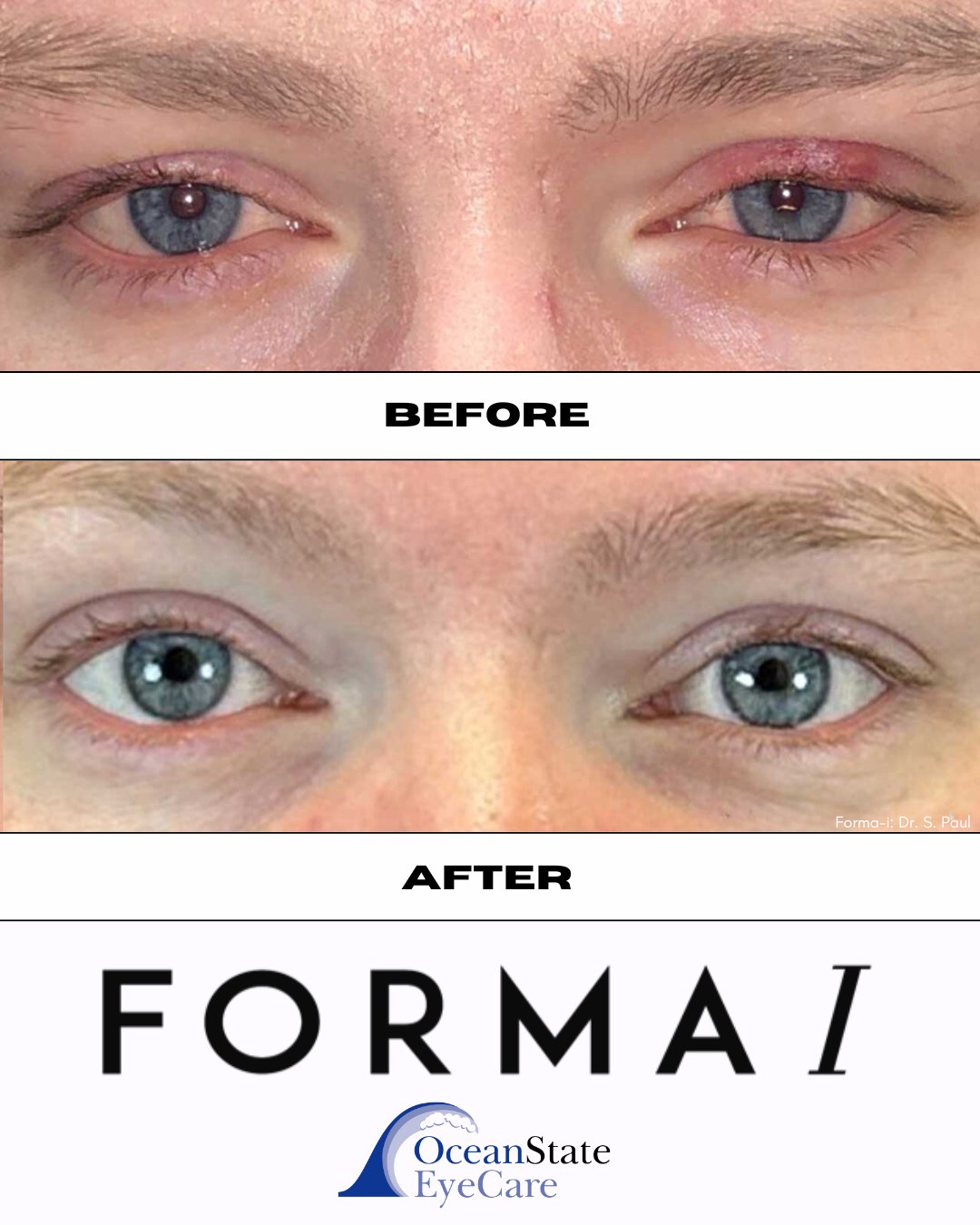 Ocean State Eye Care