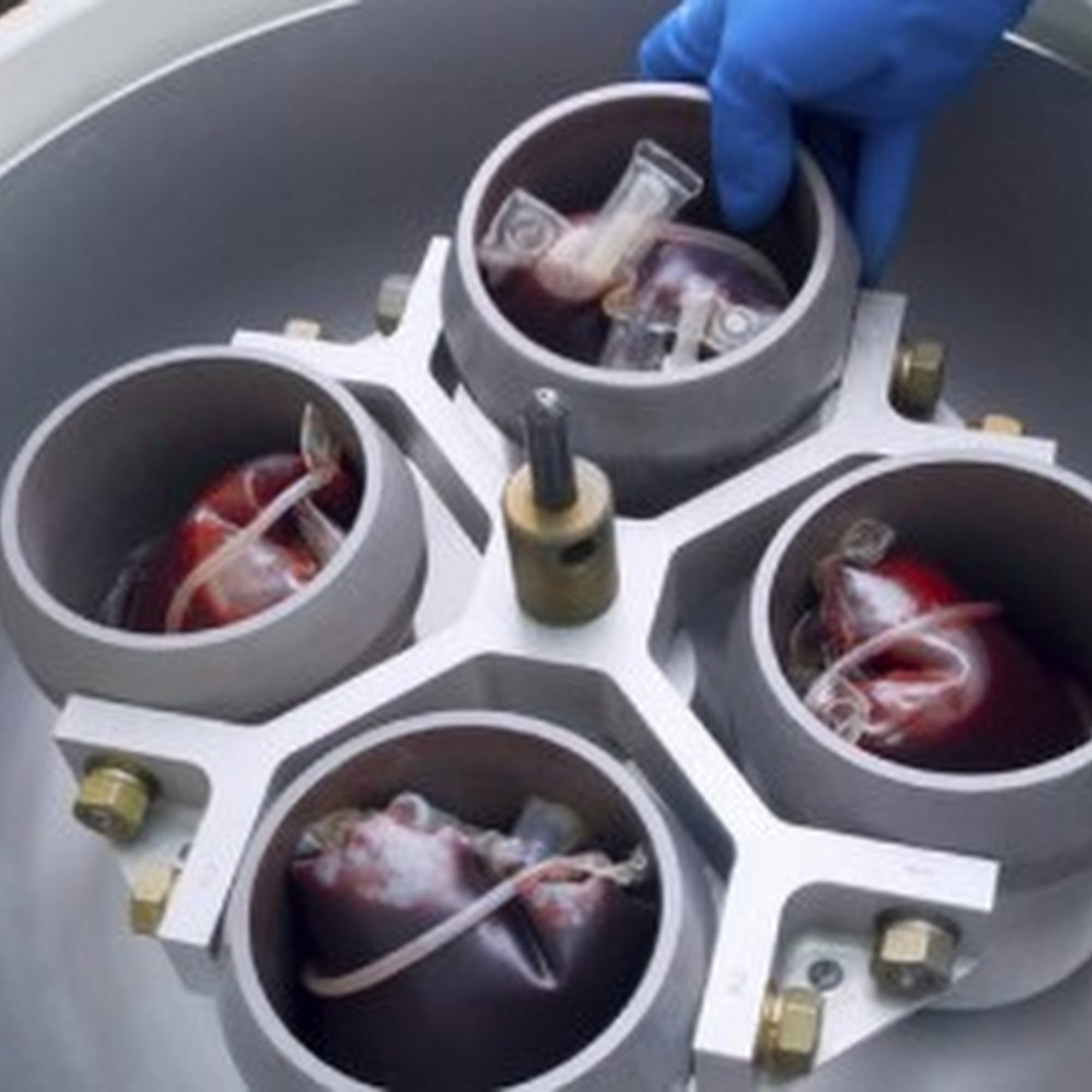 Vitrologic, Inc. Charleston