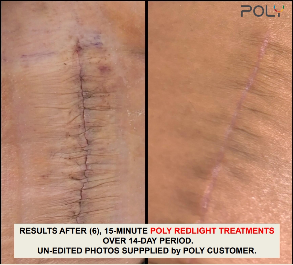 Solarium Tanning salon