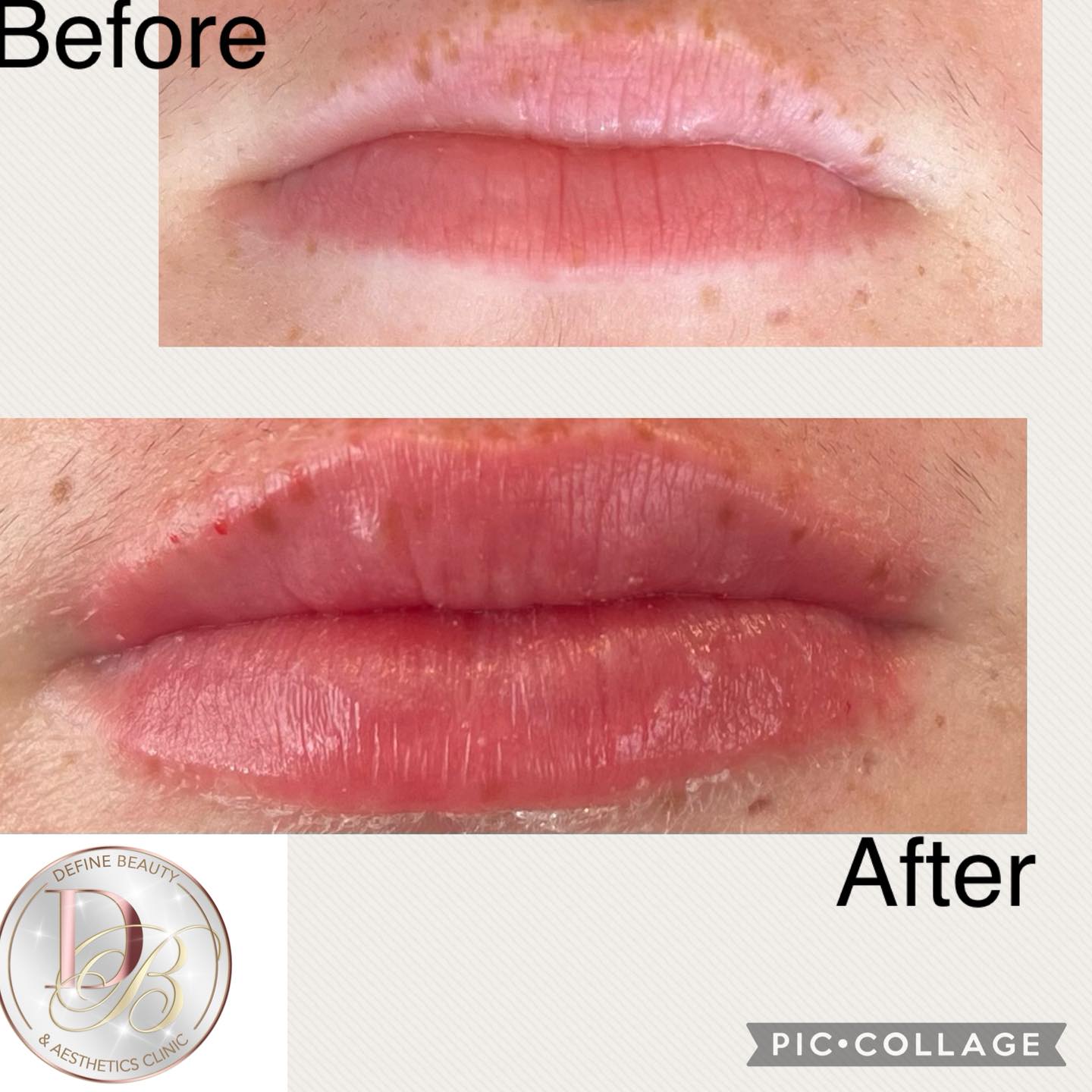 Define Beauty & Aesthetics Clinic