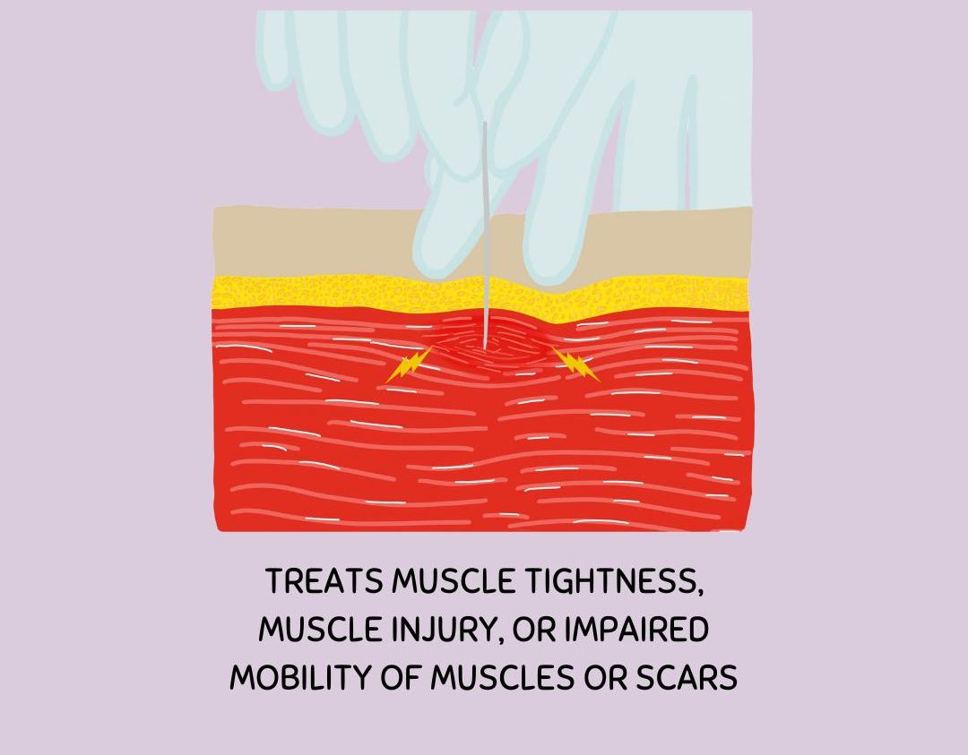 Brookings Chiropractic Center & Physical Therapy