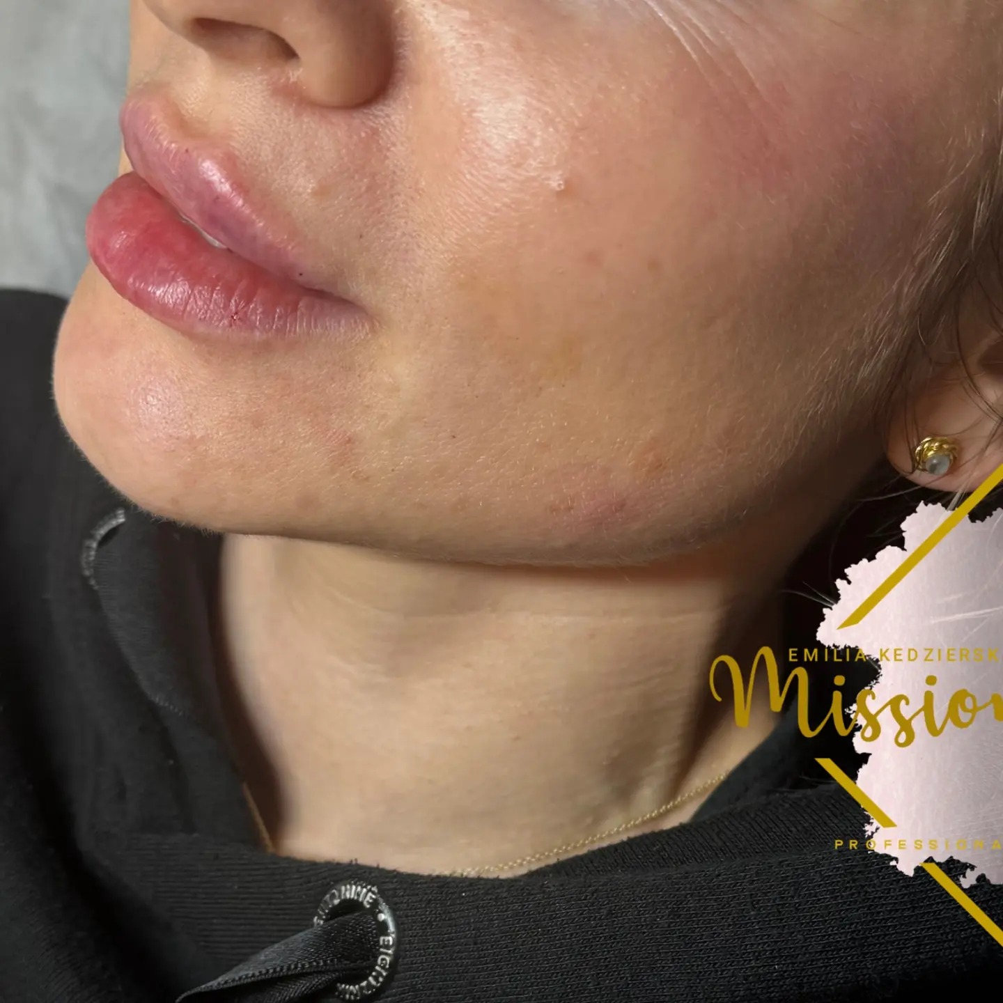 MISSION SKIN - ADVANCED FACIALS•SKIN•AESTHETICS
