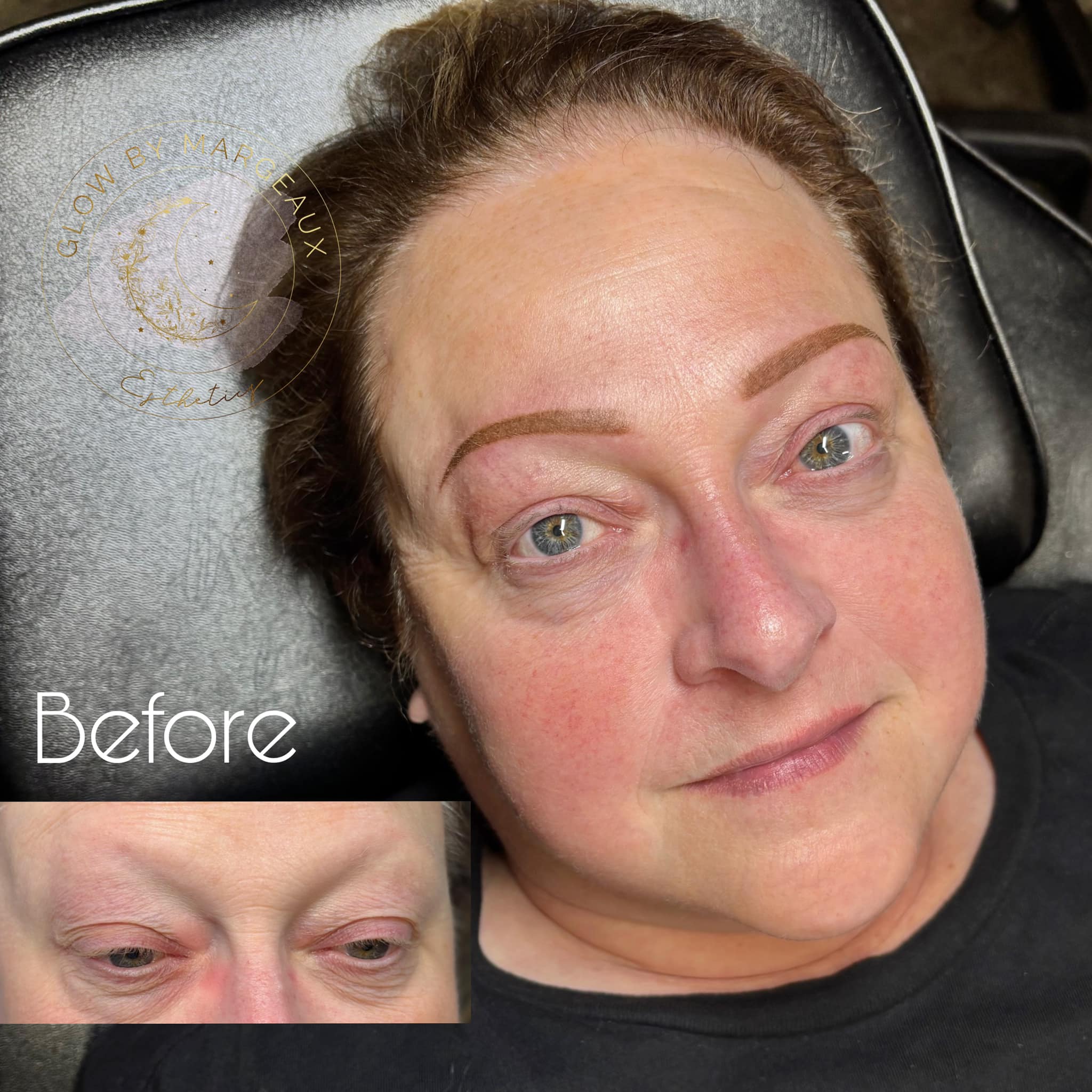 Glow By Margeaux Esthetics