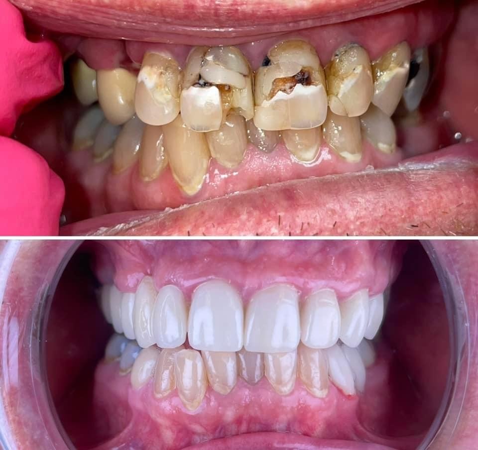 Elk River Dental