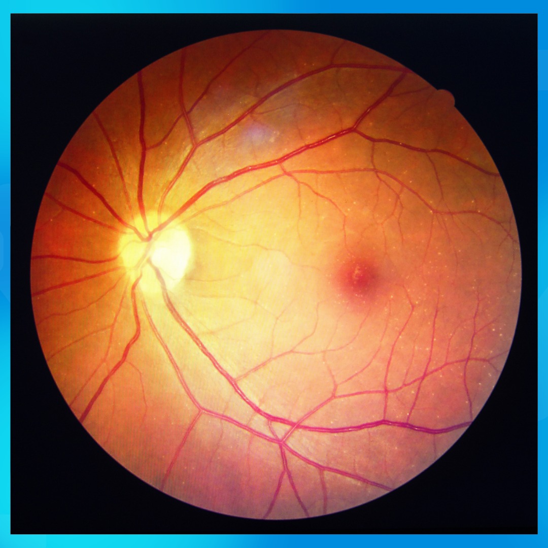 Advanced Eye Care Center