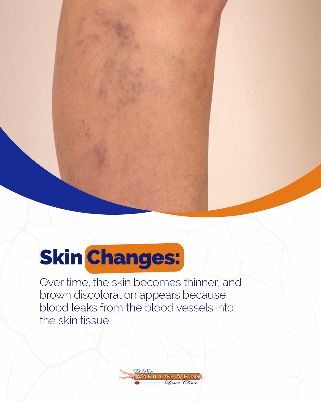 El Paso Varicose Veins Laser Clinic
