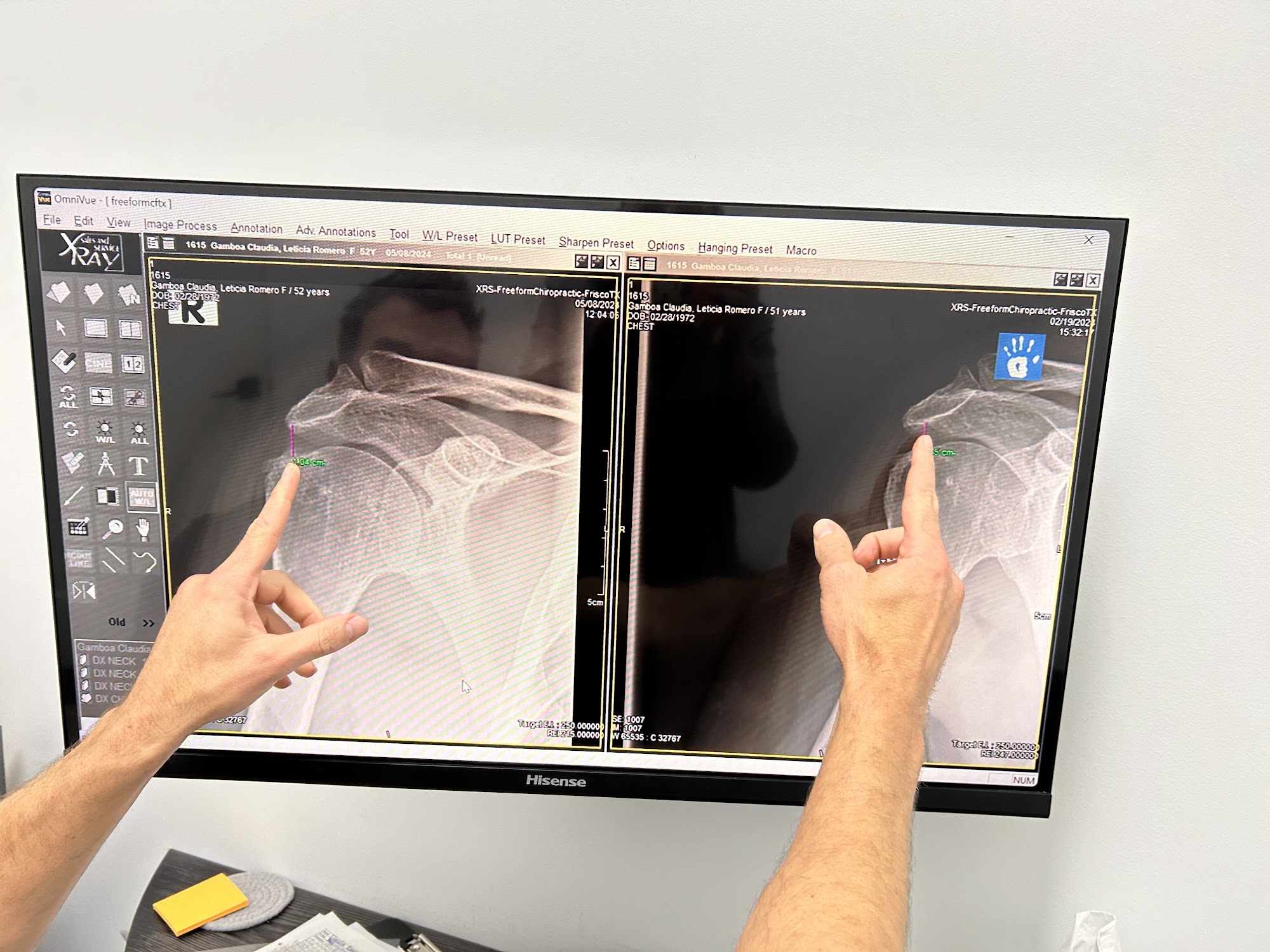 FreeForm Chiropractic - Frisco