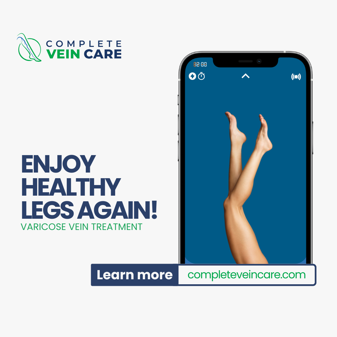 Edmonds Complete Vein Care