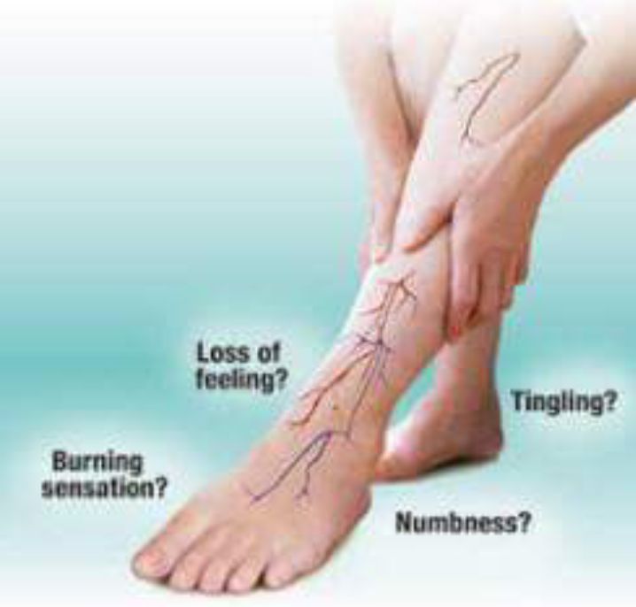 Neuropathy Treatment Center