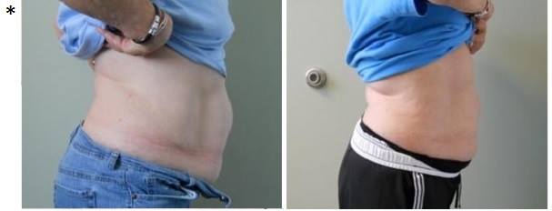 Slender Body Solutions Monroe
