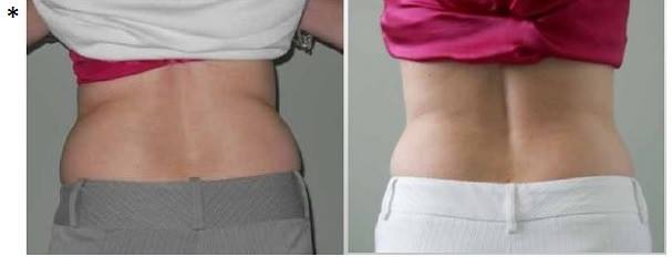 Slender Body Solutions Monroe