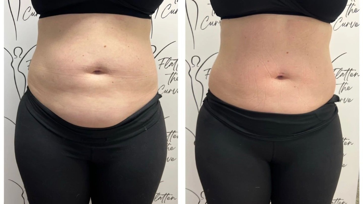 Flatten The Curve Body Sculpting 803 39th Ave SW Suite D, Puyallup Washington 98373