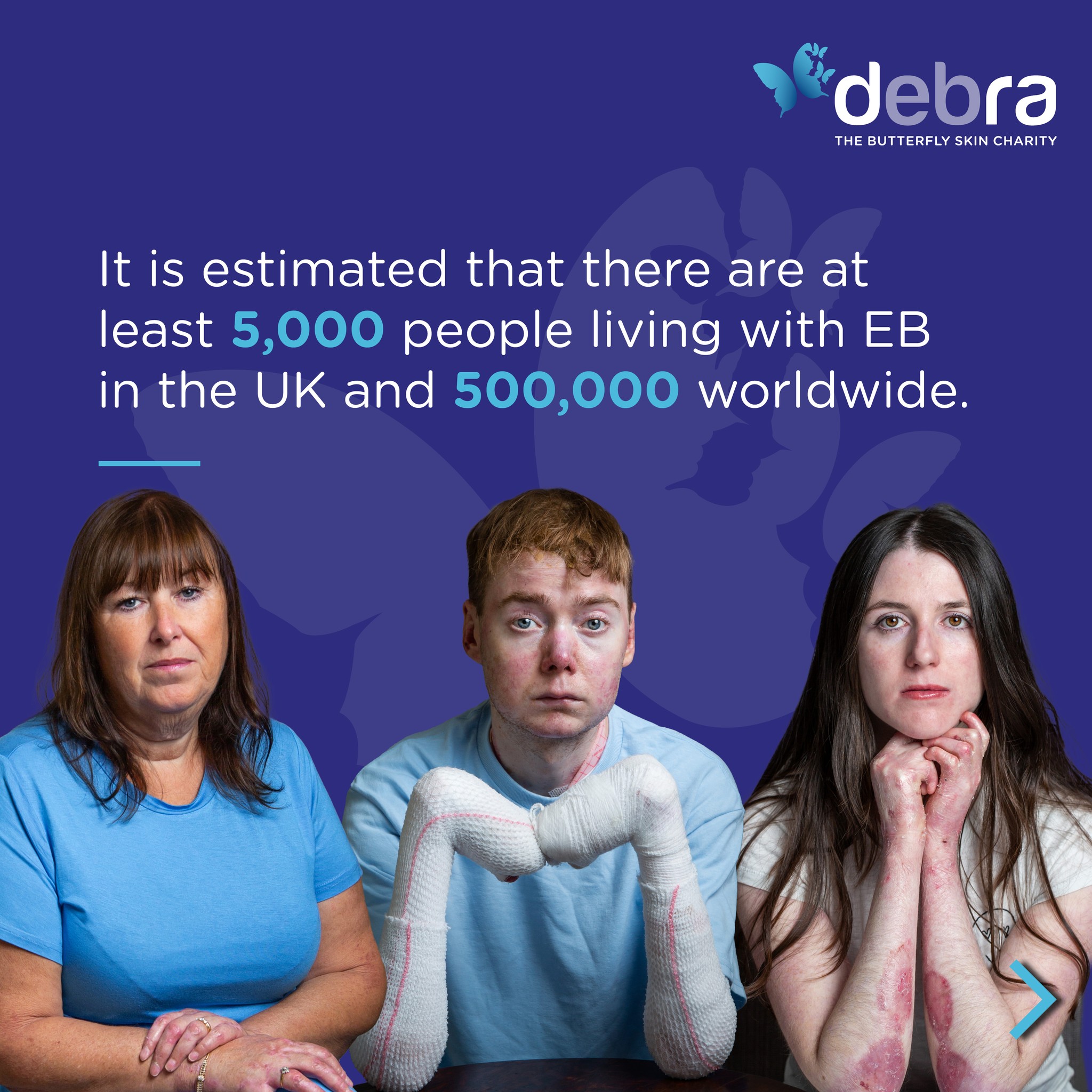DEBRA UK - Calne store